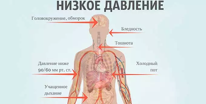 Изображение - Какие симптомы у человека при давлении 05-3